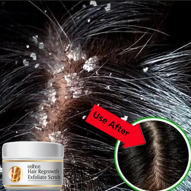 Szybki preparat przeciwłupieżo – Scalp Scrub Exfoliant recenzja i cena