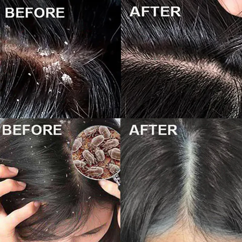 Szybki preparat przeciwłupieżo – Scalp Scrub Exfoliant recenzja i cena