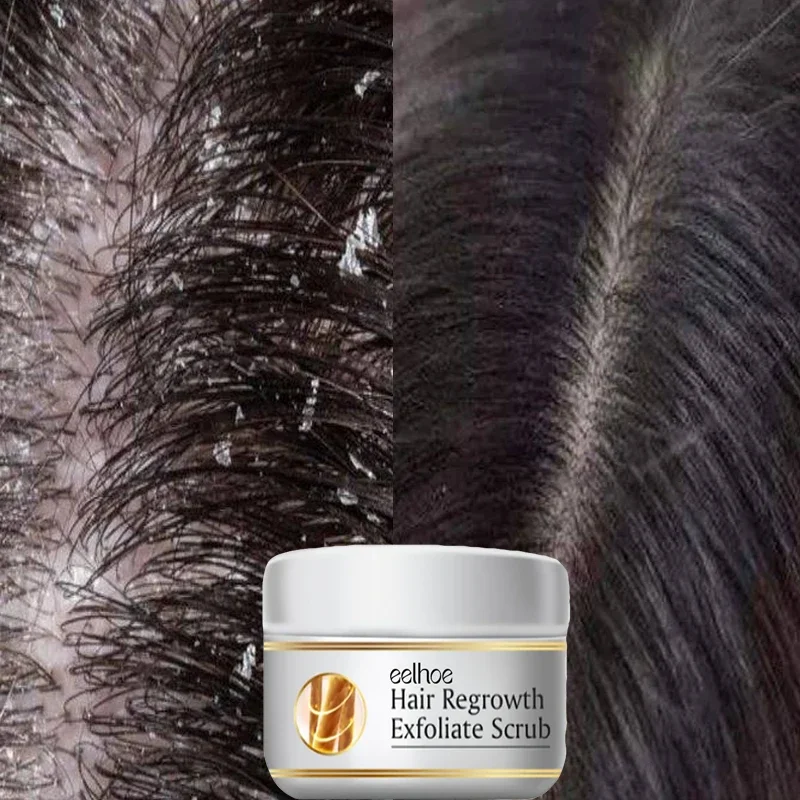 Szybki preparat przeciwłupieżo – Scalp Scrub Exfoliant recenzja i cena