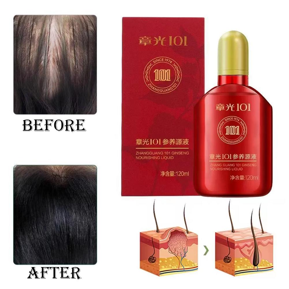 Zhang Guang 101 formula (101P) – Hair Care Normal recenzja i cena