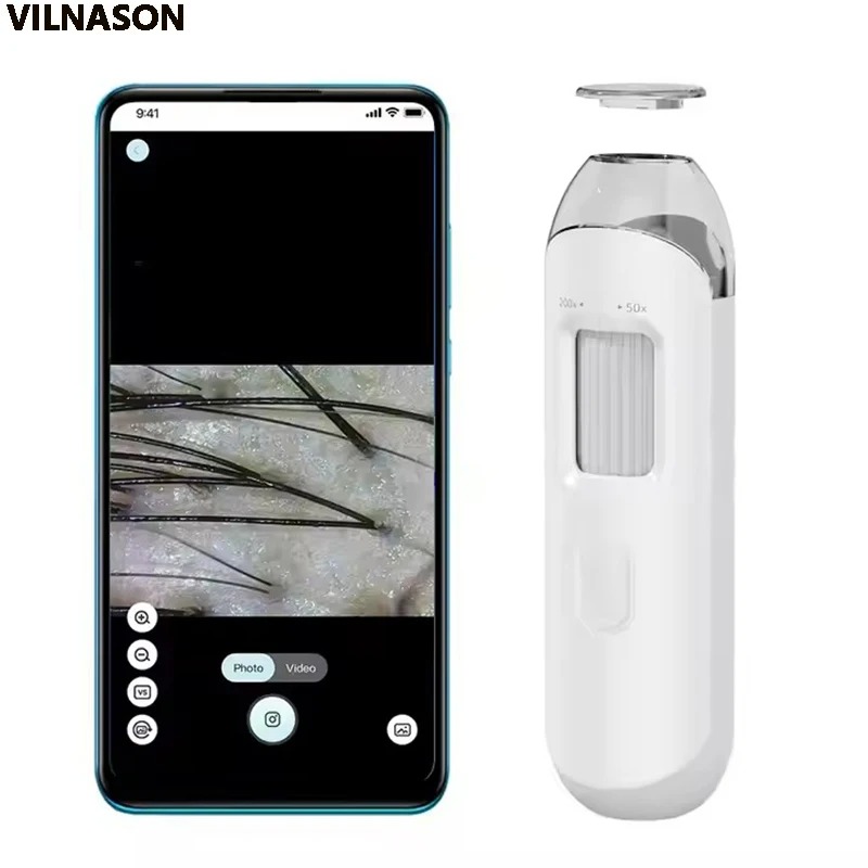 Elektronowy Dermatoskop Kamera – Hair Porosity Test recenzja i cena